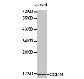 Western blot - CCL24 antibody from Signalway Antibody (38439) - Antibodies.com