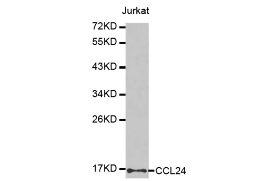 Western blot - CCL24 antibody from Signalway Antibody (38439) - Antibodies.com