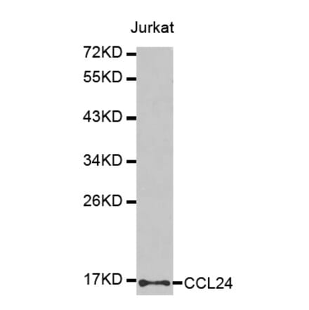 Western blot - CCL24 antibody from Signalway Antibody (38439) - Antibodies.com