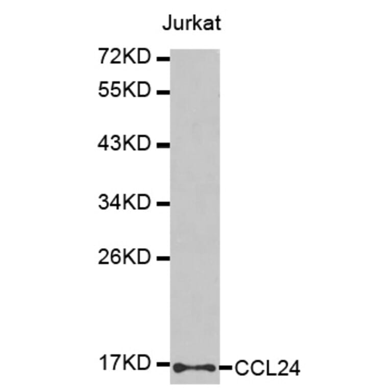 Western blot - CCL24 antibody from Signalway Antibody (38439) - Antibodies.com