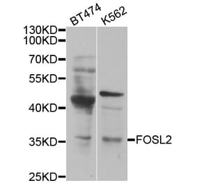 Western blot - FOSL2 antibody from Signalway Antibody (38450) - Antibodies.com