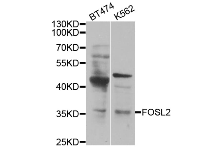 Western blot - FOSL2 antibody from Signalway Antibody (38450) - Antibodies.com