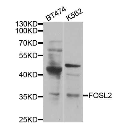 Western blot - FOSL2 antibody from Signalway Antibody (38450) - Antibodies.com