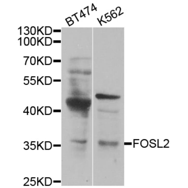 Western blot - FOSL2 antibody from Signalway Antibody (38450) - Antibodies.com