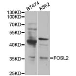 Western blot - FOSL2 antibody from Signalway Antibody (38450) - Antibodies.com