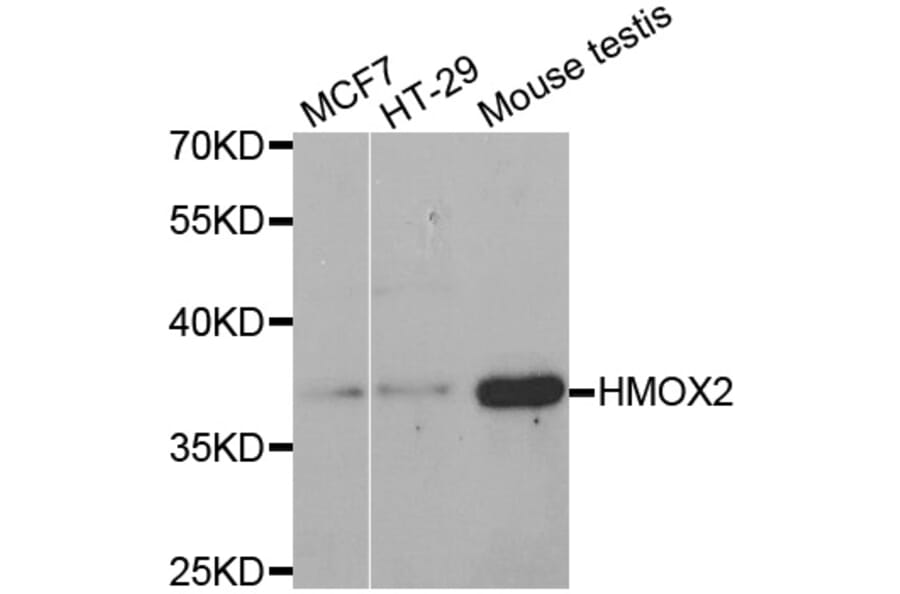 Western blot - HMOX2 antibody from Signalway Antibody (38455) - Antibodies.com