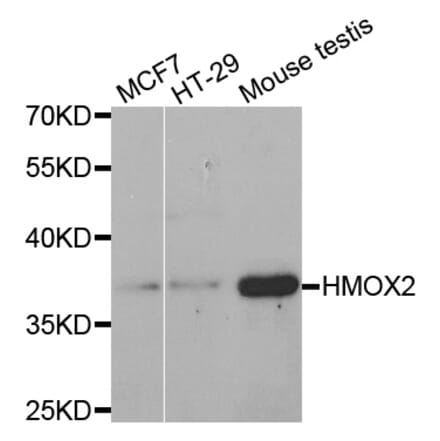 Western blot - HMOX2 antibody from Signalway Antibody (38455) - Antibodies.com