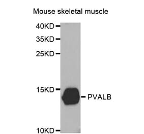 Western blot - PVALB antibody from Signalway Antibody (38467) - Antibodies.com