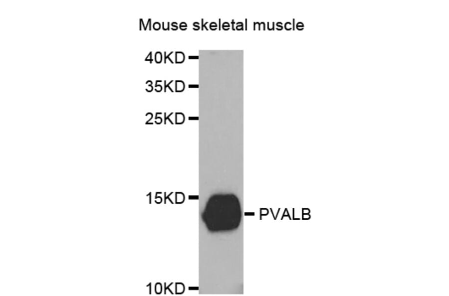 Western blot - PVALB antibody from Signalway Antibody (38467) - Antibodies.com