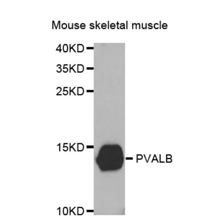 Western blot - PVALB antibody from Signalway Antibody (38467) - Antibodies.com