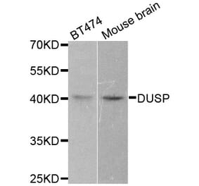 Western blot - DUSP1 antibody from Signalway Antibody (38498) - Antibodies.com