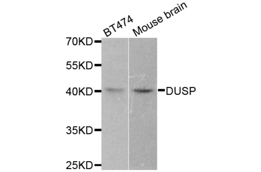 Western blot - DUSP1 antibody from Signalway Antibody (38498) - Antibodies.com