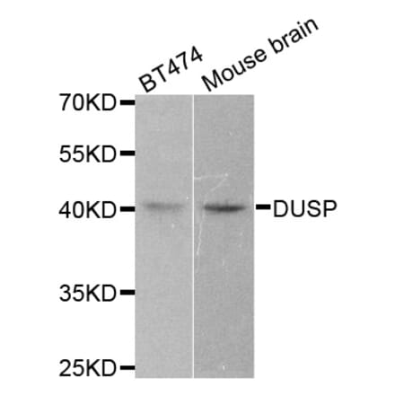 Western blot - DUSP1 antibody from Signalway Antibody (38498) - Antibodies.com
