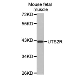 Western blot - UTS2R antibody from Signalway Antibody (38508) - Antibodies.com