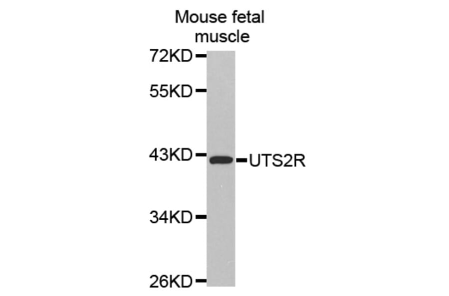 Western blot - UTS2R antibody from Signalway Antibody (38508) - Antibodies.com