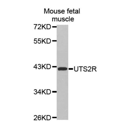 Western blot - UTS2R antibody from Signalway Antibody (38508) - Antibodies.com