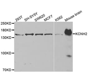 Western blot - KCNH2 antibody from Signalway Antibody (38514) - Antibodies.com