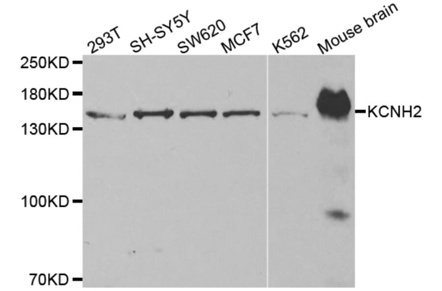 Western blot - KCNH2 antibody from Signalway Antibody (38514) - Antibodies.com