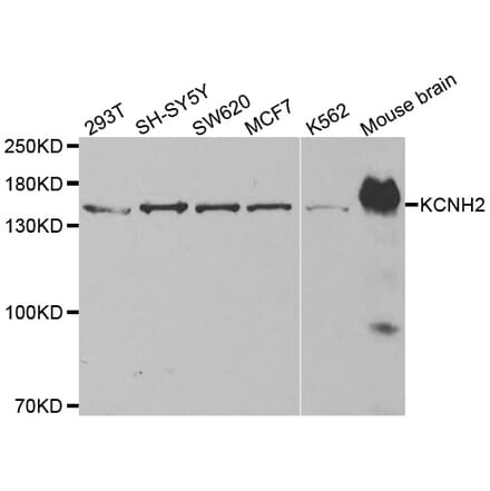 Western blot - KCNH2 antibody from Signalway Antibody (38514) - Antibodies.com