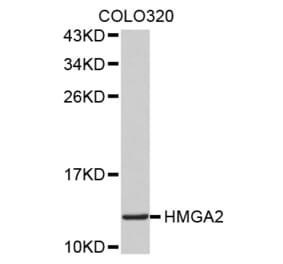 Western blot - HMGA2 antibody from Signalway Antibody (38517) - Antibodies.com