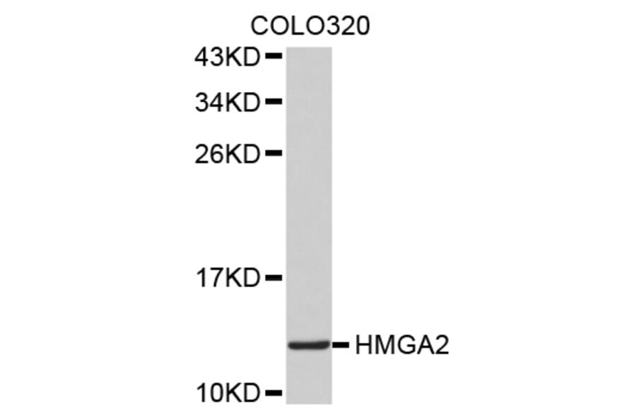 Western blot - HMGA2 antibody from Signalway Antibody (38517) - Antibodies.com