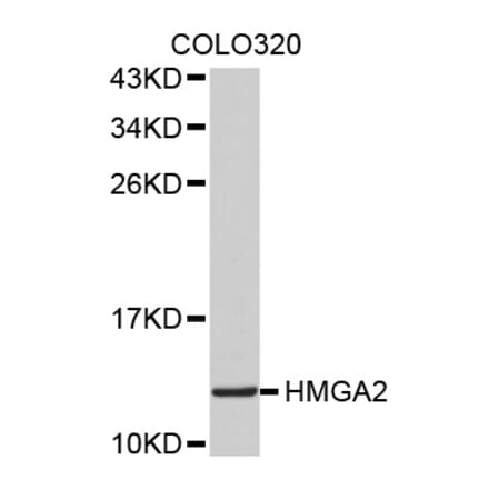 Western blot - HMGA2 antibody from Signalway Antibody (38517) - Antibodies.com