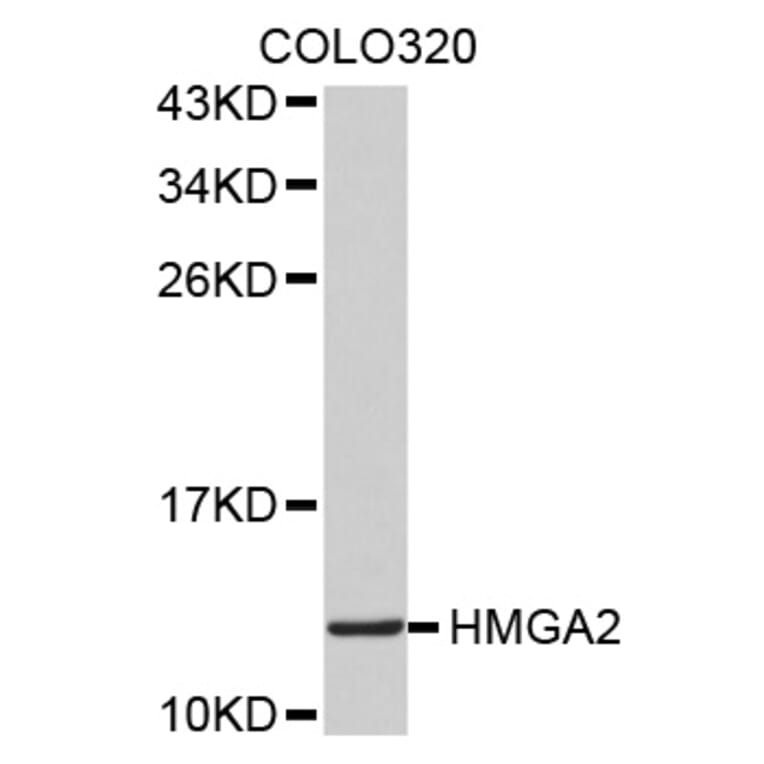 Western blot - HMGA2 antibody from Signalway Antibody (38517) - Antibodies.com