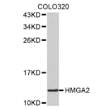 Western blot - HMGA2 antibody from Signalway Antibody (38517) - Antibodies.com