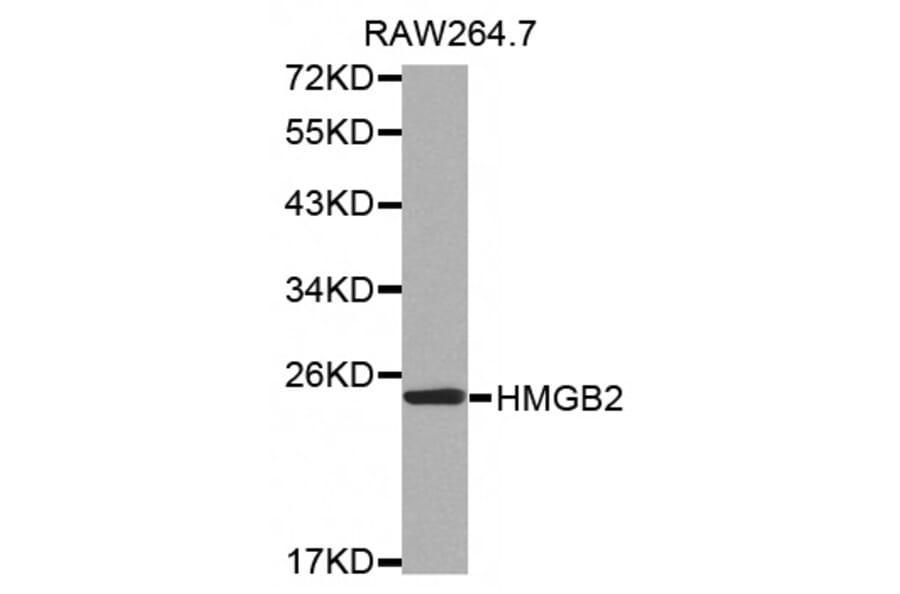 Western blot - HMGB2 antibody from Signalway Antibody (38518) - Antibodies.com
