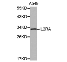 Western blot - IL2RA antibody from Signalway Antibody (38523) - Antibodies.com