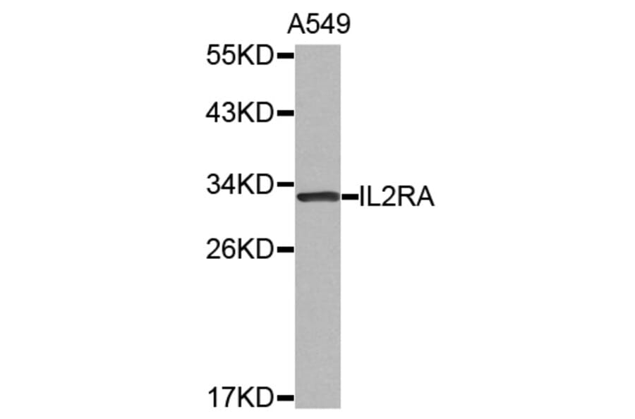 Western blot - IL2RA antibody from Signalway Antibody (38523) - Antibodies.com