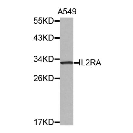 Western blot - IL2RA antibody from Signalway Antibody (38523) - Antibodies.com