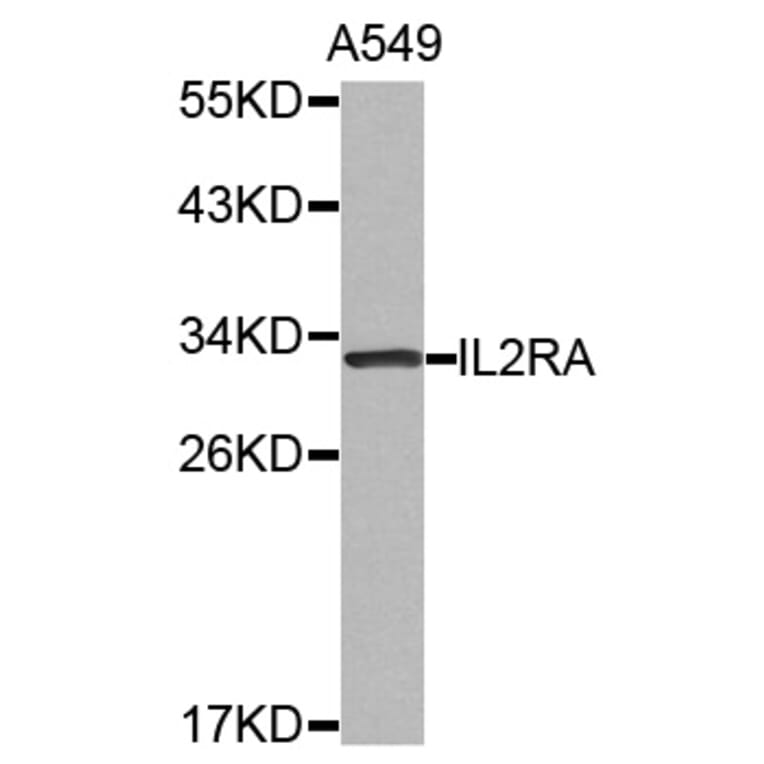 Western blot - IL2RA antibody from Signalway Antibody (38523) - Antibodies.com