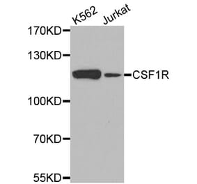 Western blot - CSF1R antibody from Signalway Antibody (38540) - Antibodies.com