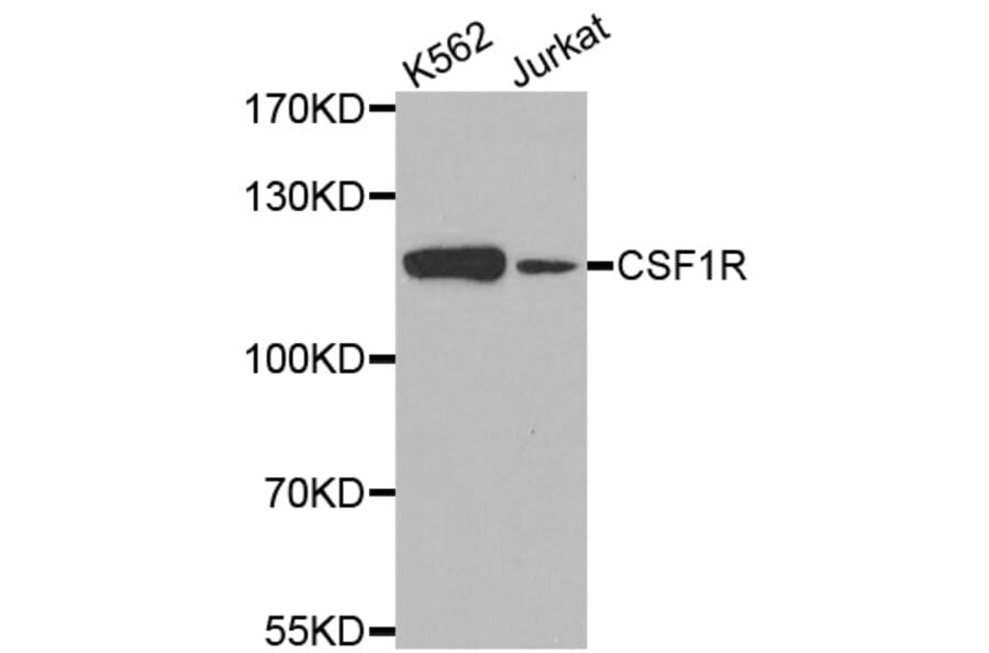 Western blot - CSF1R antibody from Signalway Antibody (38540) - Antibodies.com