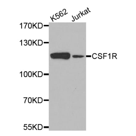 Western blot - CSF1R antibody from Signalway Antibody (38540) - Antibodies.com