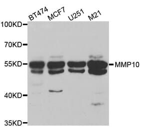 Western blot - MMP10 antibody from Signalway Antibody (38545) - Antibodies.com