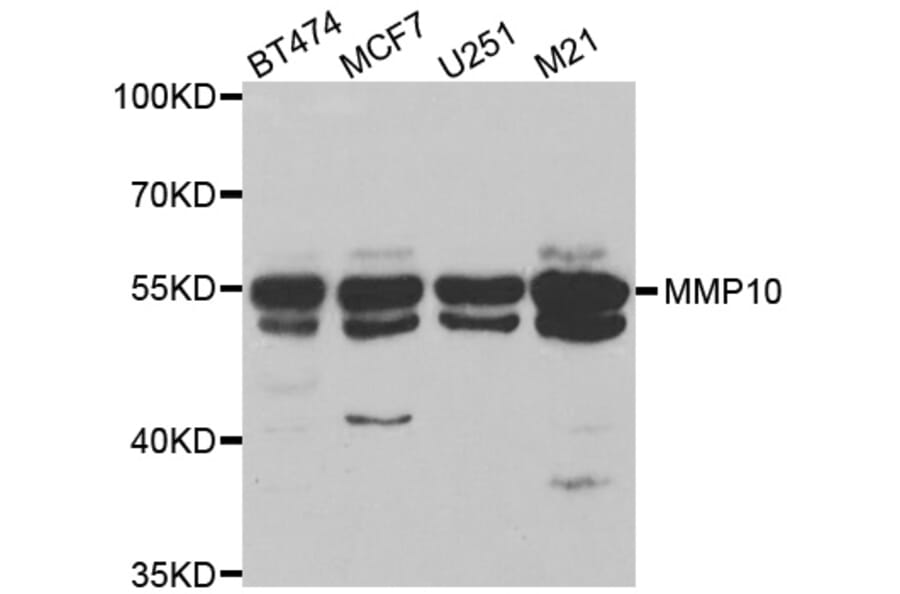 Western blot - MMP10 antibody from Signalway Antibody (38545) - Antibodies.com