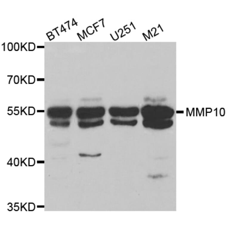 Western blot - MMP10 antibody from Signalway Antibody (38545) - Antibodies.com