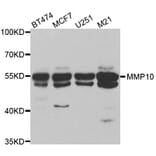 Western blot - MMP10 antibody from Signalway Antibody (38545) - Antibodies.com