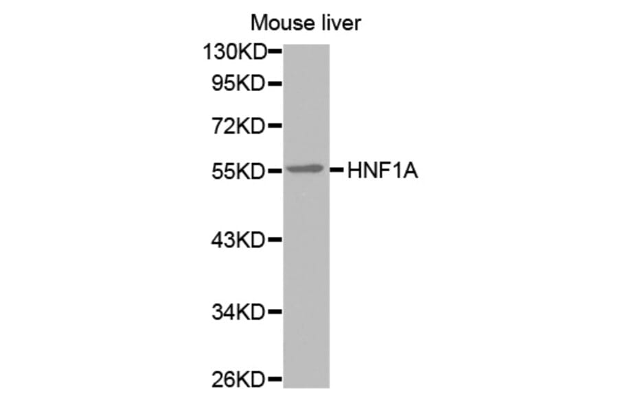 Western blot - HNF1A antibody from Signalway Antibody (38573) - Antibodies.com