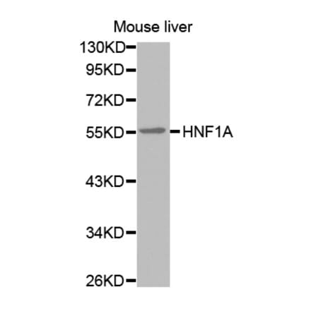 Western blot - HNF1A antibody from Signalway Antibody (38573) - Antibodies.com