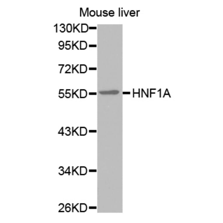 Western blot - HNF1A antibody from Signalway Antibody (38573) - Antibodies.com