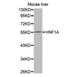 Western blot - HNF1A antibody from Signalway Antibody (38573) - Antibodies.com