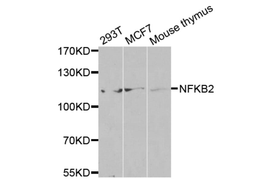 Western blot - NFKB2 antibody from Signalway Antibody (38583) - Antibodies.com