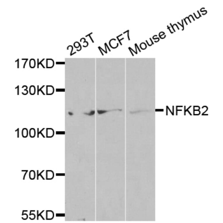 Western blot - NFKB2 antibody from Signalway Antibody (38583) - Antibodies.com