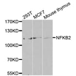 Western blot - NFKB2 antibody from Signalway Antibody (38583) - Antibodies.com