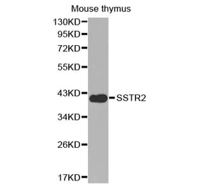 Western blot - SSTR2 antibody from Signalway Antibody (38600) - Antibodies.com