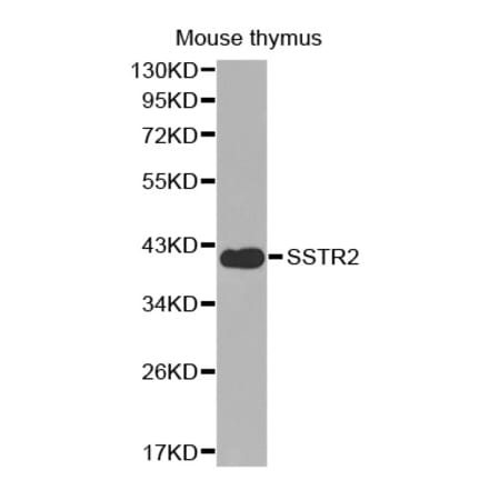 Western blot - SSTR2 antibody from Signalway Antibody (38600) - Antibodies.com