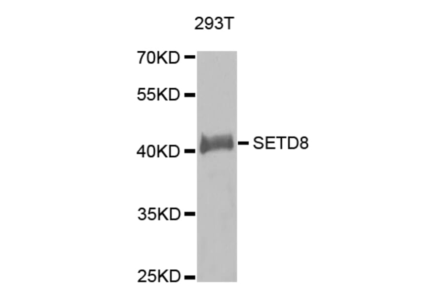 Western blot - SETD8 antibody from Signalway Antibody (38636) - Antibodies.com